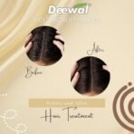DEEWAL Ayurvedic Anti-Dandruff Hair Oil - Natural Solution for Dandruff-Free Hair | Nourishing & Soothing Formula | 100% Natural Ingredients | 100ml - Fast Shipping to USA & Canada - Image 6
