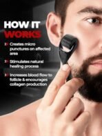 Beardo Derma Roller For Hair Growth 0.5 mm with 540 Chromium Needles | Reverse Signs of Aging | Dermaroller Increases Collagen production Repairs Damaged Hair | For Hair Fall, Hair Thickening - Fast Shipping to USA & Canada - Image 4