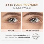 L'Oreal Paris Revitalift Hyaluronic Acid Eye Serum, 20ml, 1.5% Hyaluronic Acid and 1% Caffeine, Lightweight Texture, Non-Sticky, Reduce Fine Lines Under Eyes - Fast Shipping to USA & Canada - Image 4