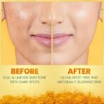 Himalaya Dark Spot Clearing Turmeric Kit (Pack of 3) | 100% Organically sourced Svarasa Turmeric | Free Jute Bag | Face Wash 100 ml | Face Pack 100 gm | Serum 30 ml | Power of Glycolic Acid & Niacinamide | Gives radiant spot free skin | Non-Staining - Fast Shipping to USA & Canada - Image 7