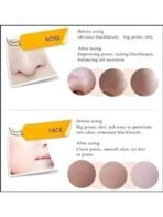 Aklaris Herbal Bamboo Charcoal Face Mask Cream | Deep Cleansing Peel-Off Face Mask | Removes Blackheads, Excess Oil & Impurities | Brightens Skin & Unclogs Pores | Anti-Acne Detox Formula 120g - Fast Shipping to USA & Canada - Image 4