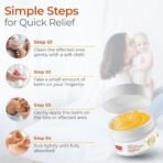 LuvLap Naturals After Bite Turmeric Balm 25g - Fast Shipping to USA & Canada - Image 7