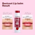 TrueWise? Tinted Lip Balm with SPF 50 PA+++ Brightening Beetroot Lip Balm For Dark Lips With Kojic Acid,Vitamin E, Soft, Glossy Lips- SPF lip balm for Women 5g - Fast Shipping to USA & Canada - Image 4